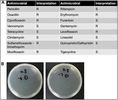 staphylococcus epidermidis negative stain