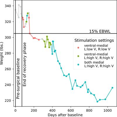 Frontiers Cognitive Task Performance During Titration Predicts Deep Brain Stimulation Treatment Efficacy Evidence From A Case Study Psychiatry