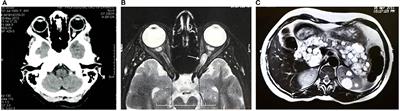 Von Hipple Lindau Disease Case Study