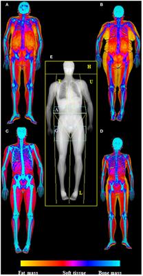 What do the numbers on a DEXA scan actually mean? - Active Seniors
