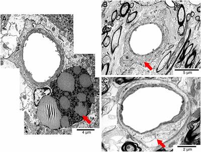 Frontiers Solving An Old Dogma Is It An Arteriole Or A Venule Frontiers In Aging Neuroscience