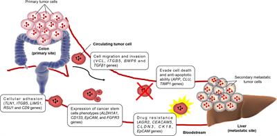 Single-cell and bulk transcriptome sequencing identifies two epithelial  tumor cell states and refines the consensus molecular classification of  colorectal cancer