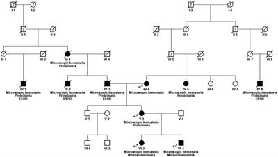 Frontiers | The Hypomorphic Variant p.(Gly624Asp) in COL4A5 as a ...