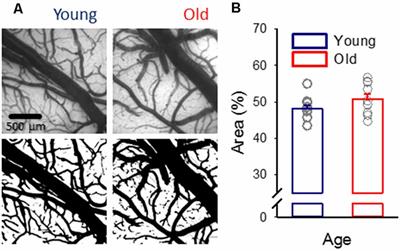 Frontiers Aging Impairs Cerebrovascular Reactivity At Preserved Resting Cerebral Arteriolar Tone And Vascular Density In The Laboratory Rat Frontiers In Aging Neuroscience