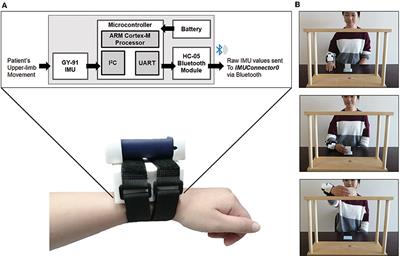 Frontiers | Quantitative Assessment of Upper Limb Motor Function in ...