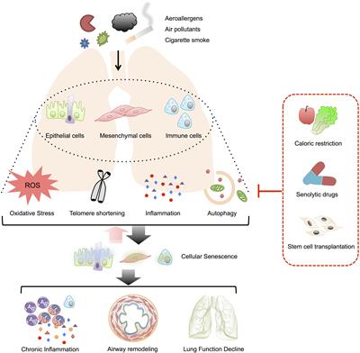 Frontiers | Potential Role of Cellular Senescence in Asthma