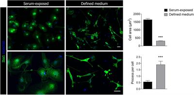 Frontiers | Functional and Metabolic Characterization of Microglia ...