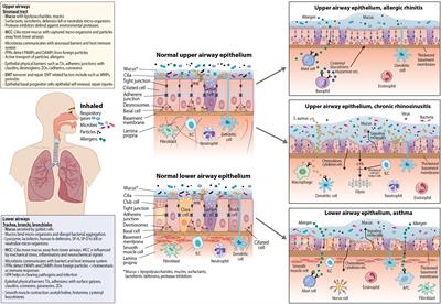 Frontiers | Airway Epithelial Dynamics in Allergy and Related Chronic ...