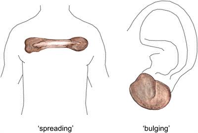 File:Foreskin Anatomy WIKI-EN.jpg - Wikimedia Commons