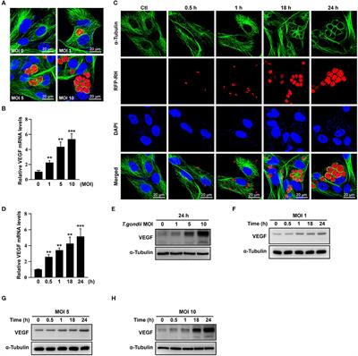 Frontiers | VEGF Production Is Regulated by the AKT/ERK1/2 Signaling ...