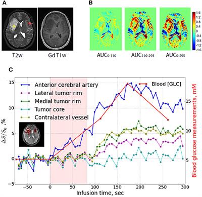 Frontiers | Non-invasive Tumor and by MRI-CEST Imaging