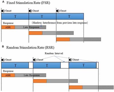 Automated cortical auditory evoked potentials threshold estimation in  neonates