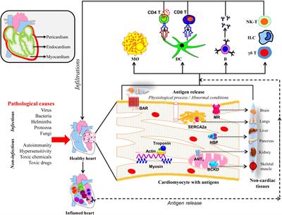 Frontiers | Triggers of Inflammatory Heart Disease