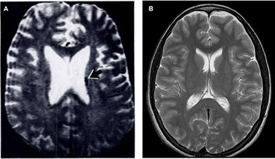 Frontiers | Low-Field MRI: How Low Can We A Fresh View on an Old