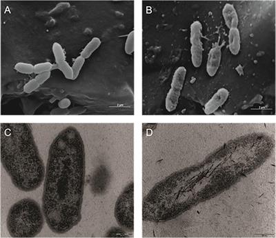 Staphylococcus aureus and Ecoli under microscope: microscopy of