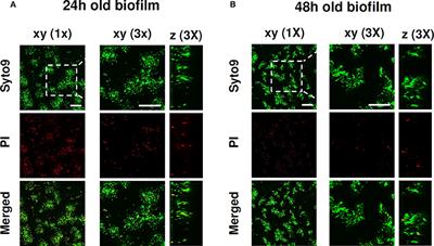 Frontiers In Vitro Interaction Of Pseudomonas Aeruginosa Biofilms With Human Peripheral Blood Mononuclear Cells Cellular And Infection Microbiology