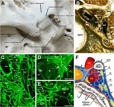 Frontiers Spinal Meningiomas From Biology To Management A