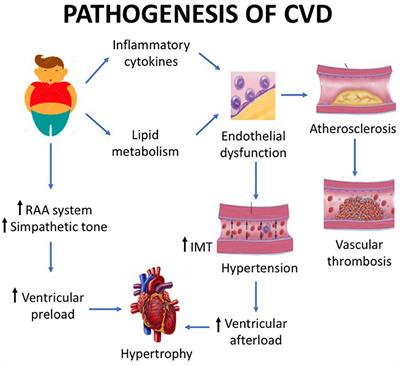 Frontiers | Cardiovascular Implications in Idiopathic and Syndromic ...