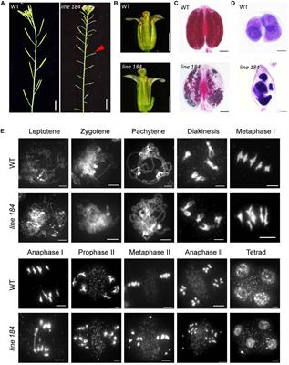 Frontiers | ATM Promotes RAD51-Mediated Meiotic DSB Repair by Inter ...