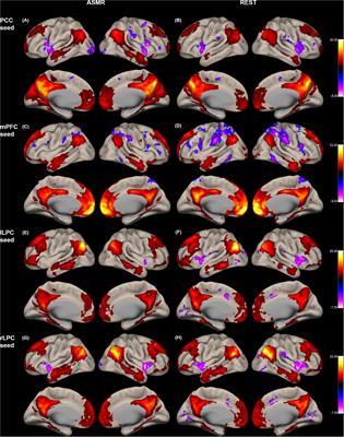 Frontiers Effects Of Autonomous Sensory Meridian Response On The Functional Connectivity As Measured By Functional Magnetic Resonance Imaging Behavioral Neuroscience