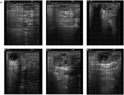 Frontiers | Platelet Rich Plasma for Regenerative Medicine Treatment of ...