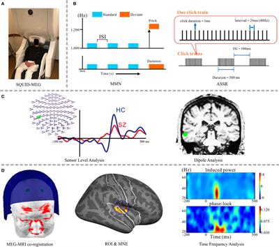 Frontiers Prospects For Future Methodological Development And Application Of Magnetoencephalography Devices In Psychiatry Psychiatry