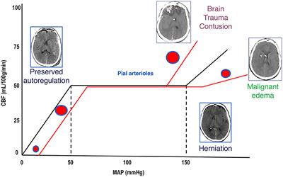 Letter to the Editor: Early seizure prophylaxis in pediatric severe  traumatic brain injury: still a long way to go in: Journal of Neurosurgery:  Pediatrics Volume 19 Issue 3 (2017) Journals