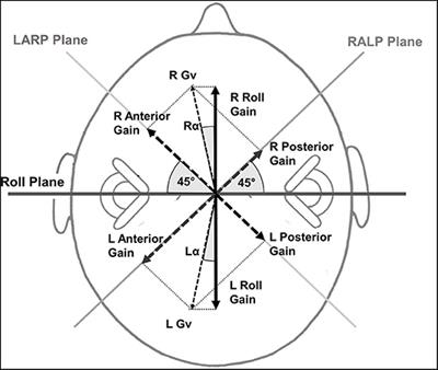 Frontiers | Improvement of Asymmetric Vestibulo-Ocular Reflex Responses ...