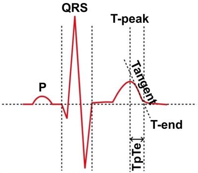 Frontiers | No Association Between T-peak to T-end Interval on the ...