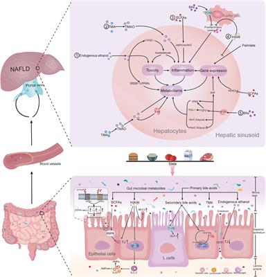 Frontiers | Microbial Metabolites: Critical Regulators in NAFLD