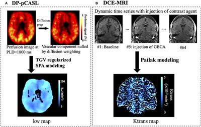 Magnetic Resonance Imaging Contrast Medium Injections Sagittal