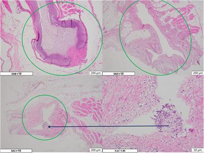 Complex Internal Microstructure Of Feather Follicles On Chicken Skin Promotes The Bacterial Cross Contamination Of Carcasses During The Slaughtering Process Microbiology Frontiers