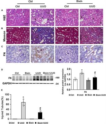 Frontiers | Bixin Protects Against Kidney Interstitial Fibrosis Through ...