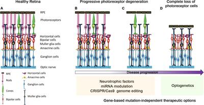 Cellular responses following retinal injuries and therapeutic approaches  for neurodegenerative diseases - ScienceDirect