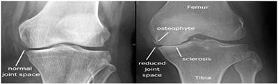 Frontiers | Automatic Detection and Classification of Knee ...