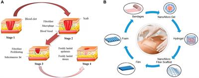 Frontiers | Latest Advances on Bacterial Cellulose-Based Antibacterial ...