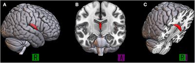 Frontiers | Fornix Integrity Is Differently Associated With Cognition ...