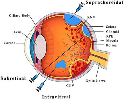 Overcoming Retinal Diseases: Can the Retina Heal Itself