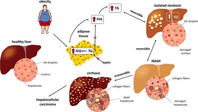 Frontiers | Pathophysiology of NAFLD and NASH in Experimental Models ...