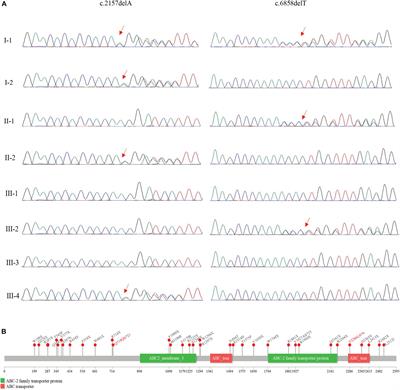 Frontiers Case Report Prenatal Diagnosis Of A Fetus With Harlequin Ichthyosis Identifies Novel Compound Heterozygous Variants A Case Report Genetics