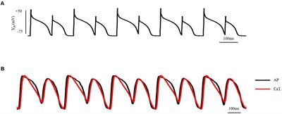 PDF) A RARE FINDING OF MACROVOLT T WAVE ALTERNANS