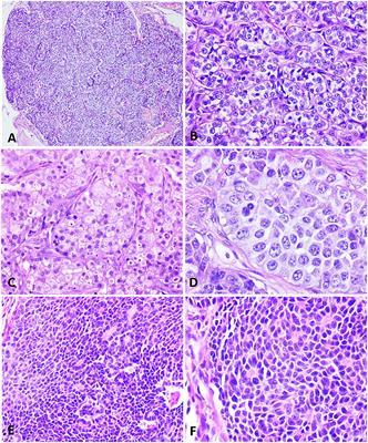 Frontiers | Neuroendocrine Carcinomas of the Canine Mammary Gland ...