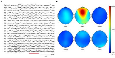 Frontiers | Changes in Electroencephalography and Cardiac Autonomic ...