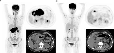 Frontiers | The Clinical Accuracy and Risk Stratification in End of ...