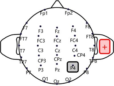 Electrode placement on the face for the both the ES and sham protocol.