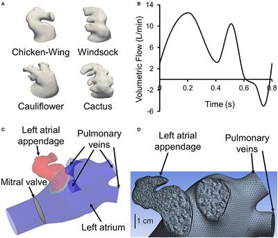 Frontiers | Subject-Specific Calculation of Left Atrial Appendage Blood ...