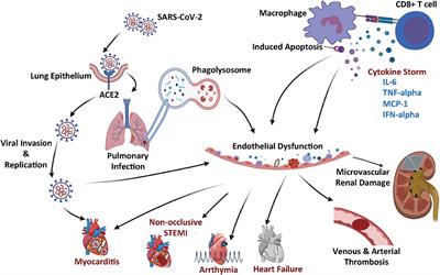 Frontiers | Microvascular Angiopathic Consequences of COVID-19