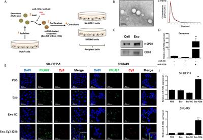 Exosomal Mir 125b Exerts Anti Metastatic Properties And Predicts Early Metastasis Of Hepatocellular Carcinoma Oncology Frontiers