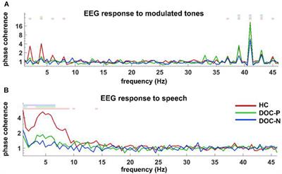 Neural Markers of Speech Comprehension: Measuring EEG Tracking of