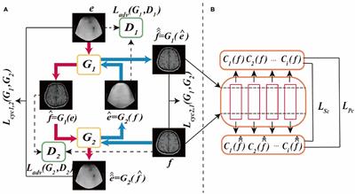 Research On The Modality Transfer Method Of Brain Imaging Based On Generative Adversarial Network Neuroscience Frontiers